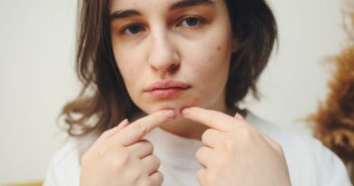 The Beauty of Imperfection in Our Lives